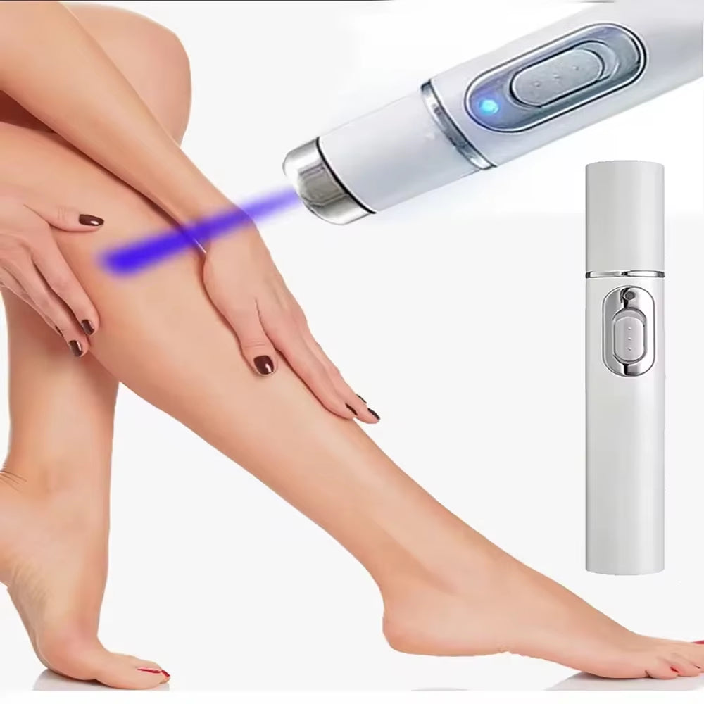 Varicose Vein Lampshade Therapy Effective Improved Blood Circulation Relief of Dilated Vasculitis in the Legs Phlebitis